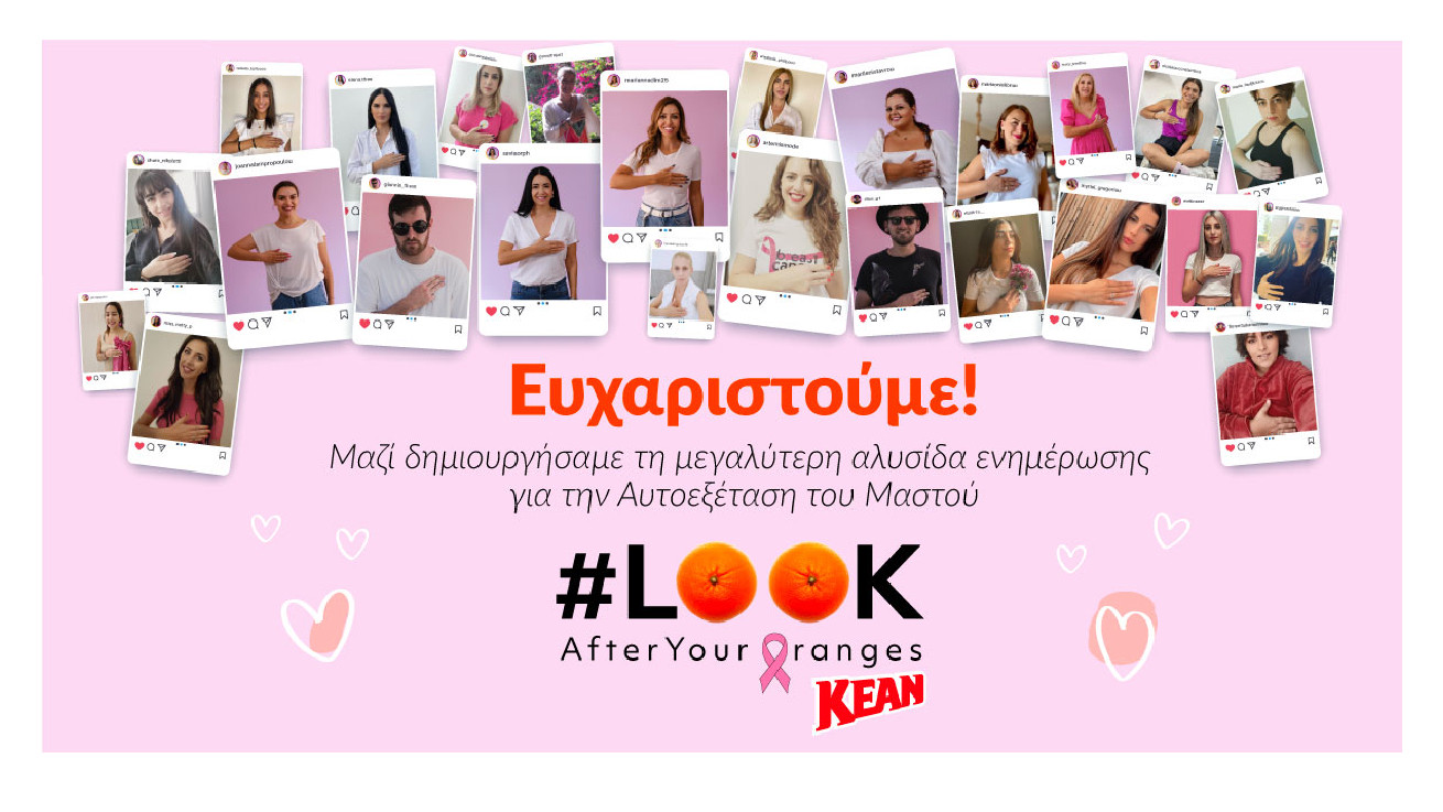 KEAN: 1000 φωτογραφίες και €3000 στην Europa Donna Κύπρου