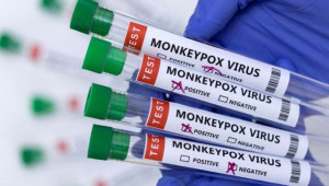 ΗΠΑ: Στα 1.053 ανήλθαν τα επιβεβαιωμένα κρούσματα ευλογιάς των πιθήκων
