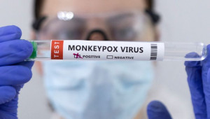 Στην Ισπανία καταγράφηκε ο 1ος θάνατος από την ευλογιά των πιθήκων στην Ευρώπη