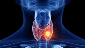 Τετραπλάσιος από τον Ευρωπαϊκό ο μ.ο. καρκίνου θυρεοειδούς στην Κύπρο