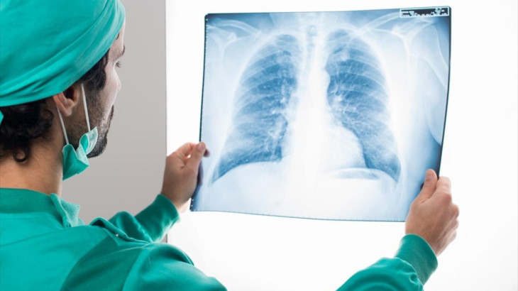 Ποιοι έχουν καλύτερες πιθανότητες επιβίωσης από καρκίνο του πνεύμονα